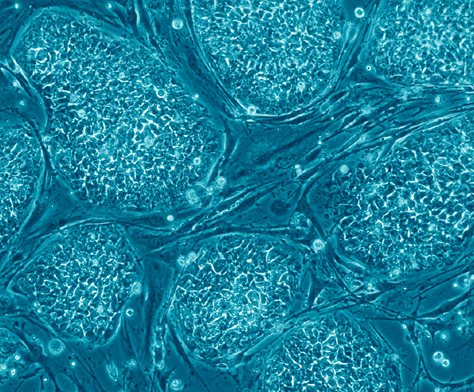 Nissim Benvenisty — Russo E. (2005) Follow the Money—The Politics of Embryonic Stem Cell Research. PLoS Biol 3(7): e234