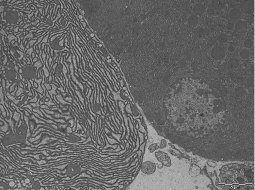 Deux cellules acineuses observées au microscope électronique à transmission